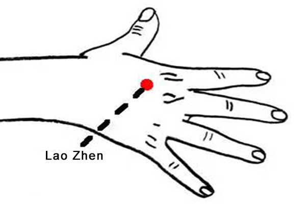 LaoZhen acupoint