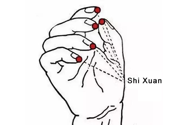 ShiXuan acupoint